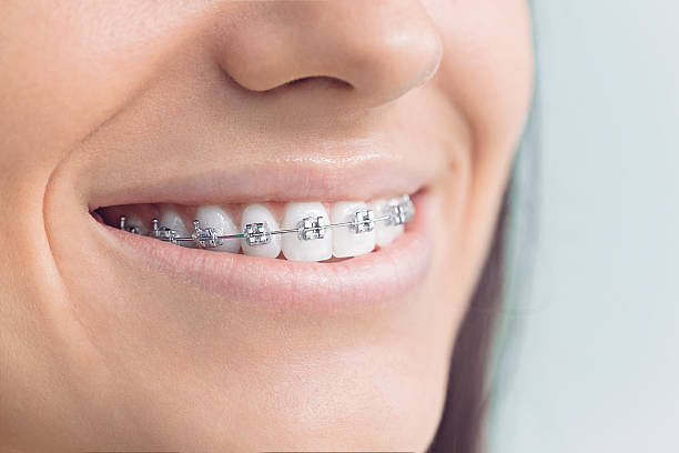 Best Dental Inlays and Onlays  in Monson Center, MA